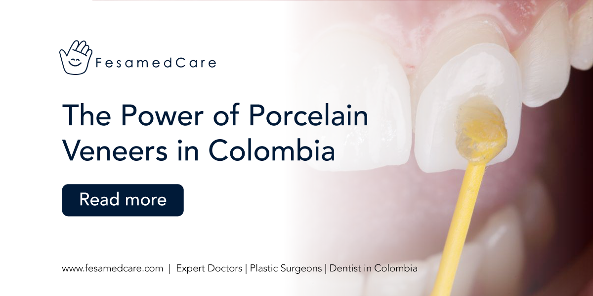 The Power of Porcelain Veneers in Colombia Fesamedcare Consultation