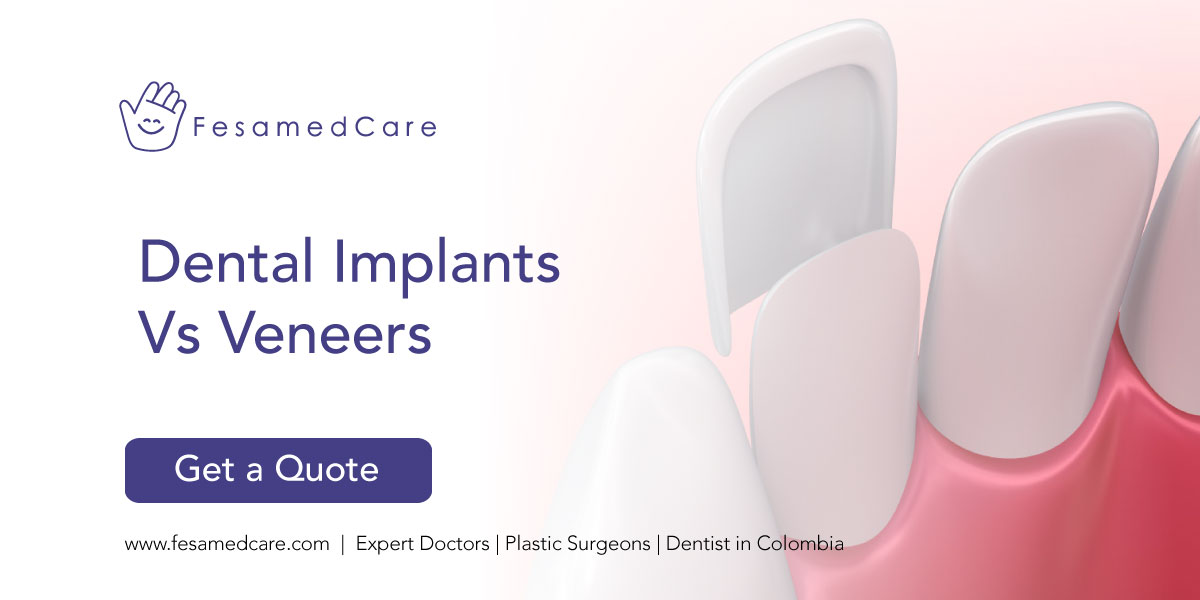 Dental Implants Vs Veneers Fesamedcare Consultation with Doctors